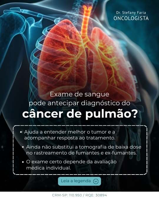 Exame de sangue pode antecipar diagnóstico do câncer de pulmão